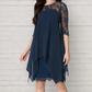 ?? LIMITED TIME 50% OFF! ?? Women's Elegant High-Low Hem Lace Overlay Dress – Stunning Lace Detail & Trendy Silhouette ??