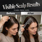 🪥 LIMITED TIME 50% OFF! 💆 Scalp Applicator Comb Tool – Precision Tips, Gentle Massage & Easy Use – Perfect for Serums, Oils & Scalp Care ✨