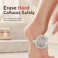 🦶 50% OFF! ✨ 3-in-1 Callus Remover & Foot Scrub – Safe 304 Stainless Steel, Soft Rubber Toe Bristles & Pumice Stone – Smooth Soft Feet in 3 Simple Steps 🔧
