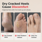 🦶 50% OFF! ✨ 3-in-1 Callus Remover & Foot Scrub – Safe 304 Stainless Steel, Soft Rubber Toe Bristles & Pumice Stone – Smooth Soft Feet in 3 Simple Steps 🔧